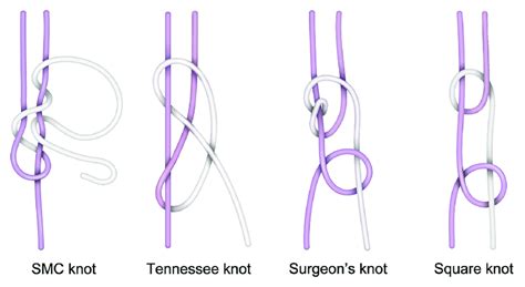 Knots in medical devices: