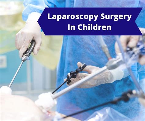 Laparoscopy in Children PDF