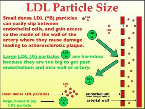 Ldl Particle Size Chart