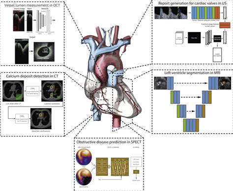 Learning Cardiac Imaging Reader