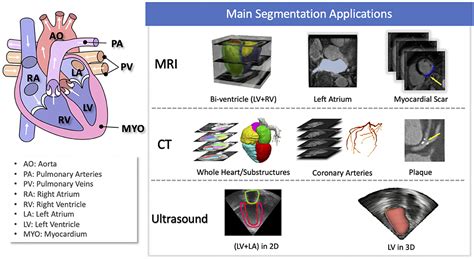 Learning Cardiac Imaging Reader