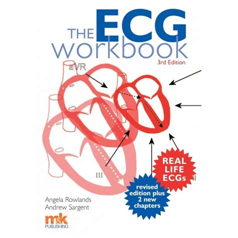 Learning ECGS Workbook Kindle Editon