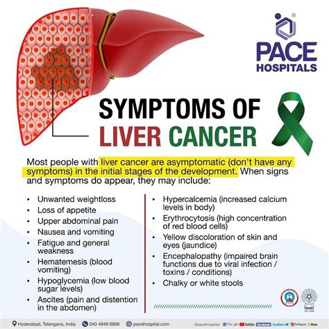 Liver Cancer End Stage Symptoms: A Comprehensive Guide to Understanding the 10 Terminal Signs