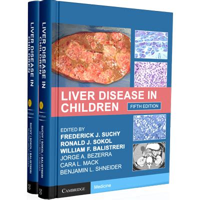 Liver Disease in Children 2nd Edition Kindle Editon