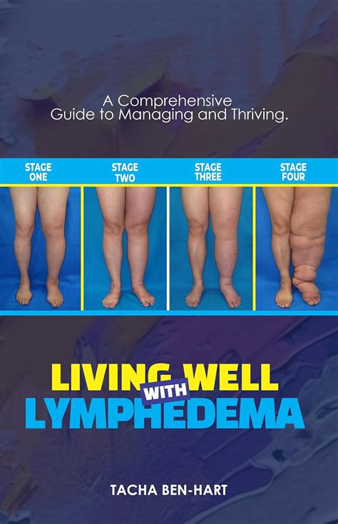 Living Well with Lymphedema Doc