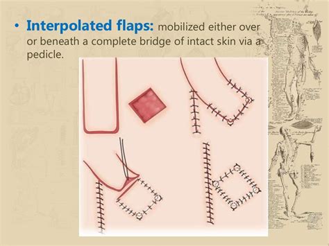 Local Flap Reconstruction Epub