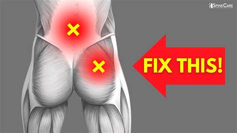 Lower Back and Buttocks Pain: Don't Let Sitting Ruin Your Day