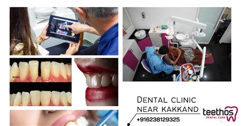 Loyang Point Dental: A Comprehensive Guide to Exceptional Dental Care