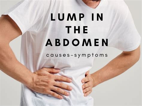 Lump in the Abdomen: A Comprehensive Guide to Symptoms, Causes, and Treatment