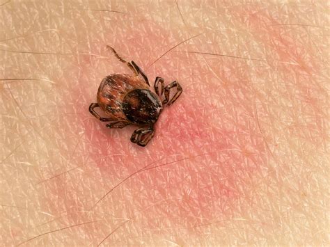 Lyme Disease & Dogs: 10 Facts You Need to Know