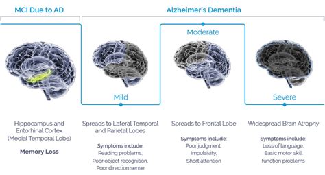 MCI and Alzheimer's Dementia Reader