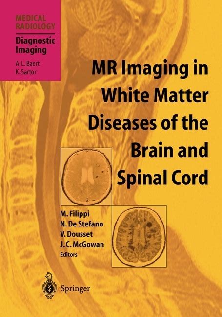 MR Imaging in White Matter Diseases of the Brain and Spinal Cord 1st Edition Epub