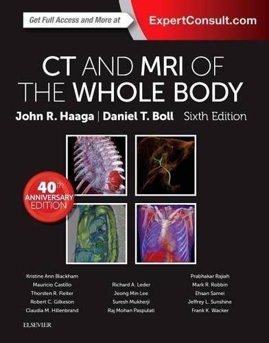 MR Imaging of the Body 1st Edition Kindle Editon