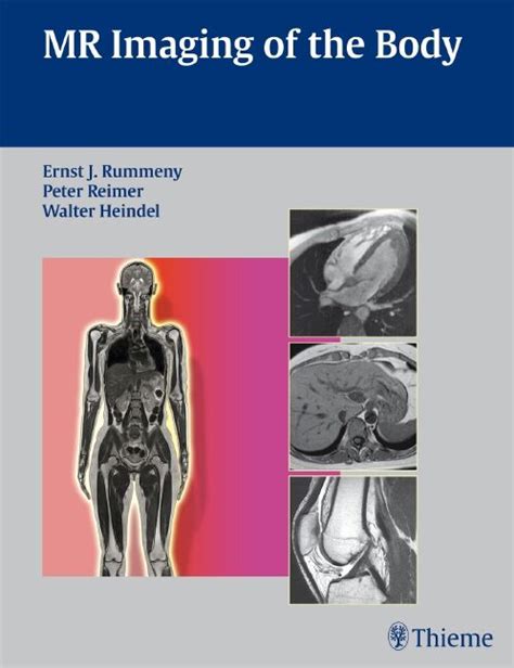 MR Imaging of the Body 1st Edition Kindle Editon