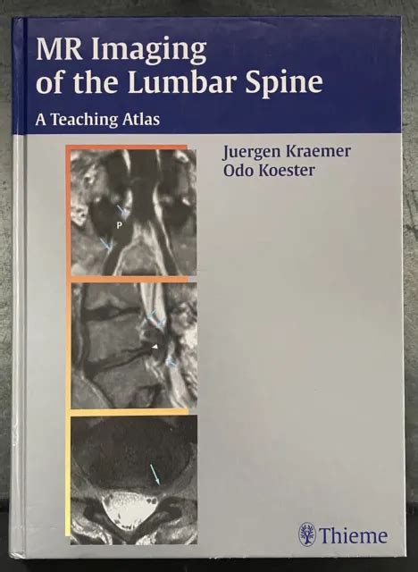 MR Imaging of the Lumbar Spine A Teaching Atlas 1st Edition Reader
