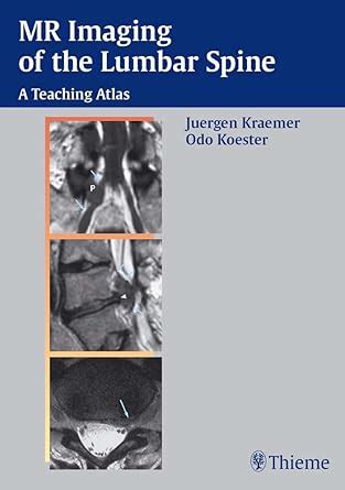 MR Imaging of the Lumbar Spine A Teaching Atlas 1st Edition Reader