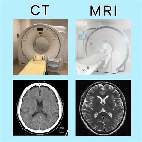 MRI・CTスキャン: