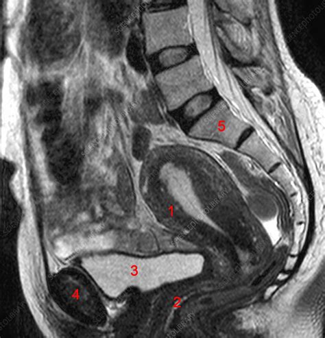 MRI and CT of the Female Pelvis Reader