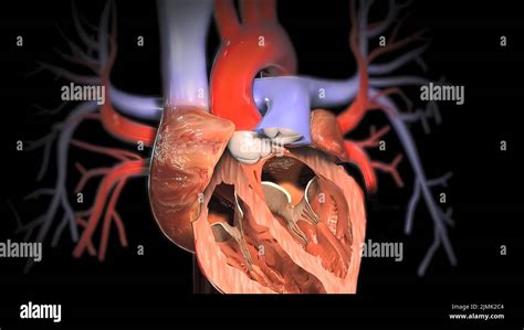 MRI of the Cardiovascular System Epub