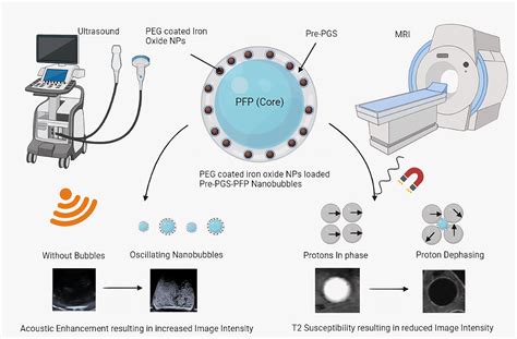 Magnetic Resonance Imaging (MRI) Contrast Agent: