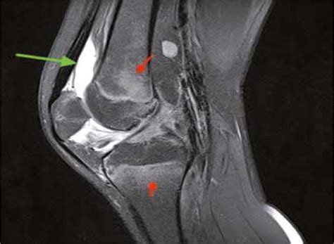 Magnetic Resonance Imaging of the Knee Epub