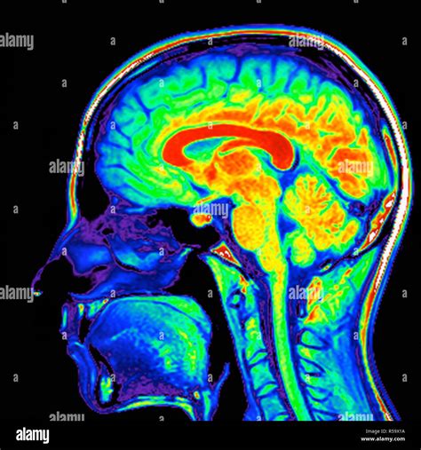 Magnetic Source Imaging of the Human Brain Reader