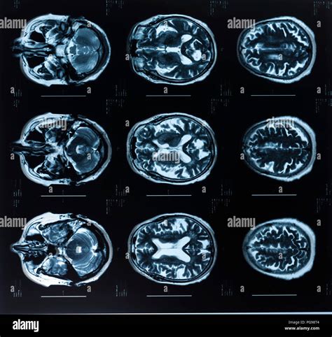 Magnetic Source Imaging of the Human Brain Reader