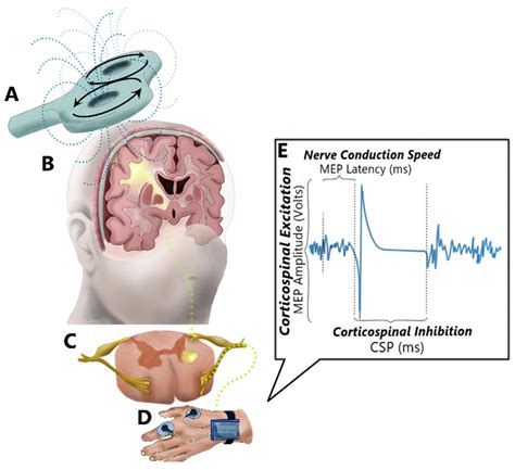 Magnetic Stimulation of the Human Nervous System Kindle Editon