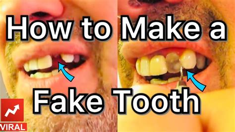 Make a Fake Tooth at Home in 10 Easy Steps