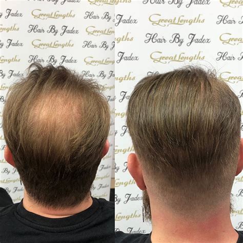 Male Hair Extensions: A Growing Trend