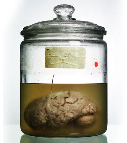 Malformed Forgotten Brains of the Texas State Mental Hospital Reader