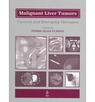 Malignant Liver Tumors Current and Emerging Therapies Doc