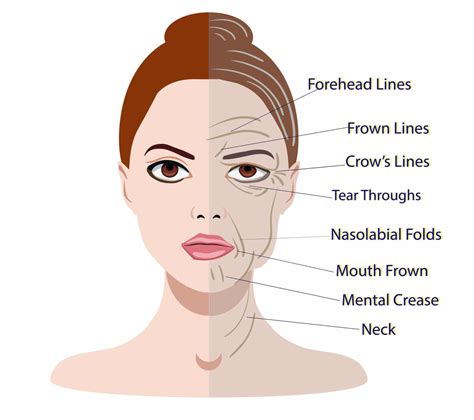 Management of Facial Lines and Wrinkles Reader