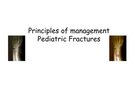 Management of Pediatric Fractures Reader