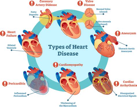 Managing Major Diseases Vol 2 Cardiac Disorders Kindle Editon