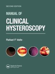 Manual of Clinical Hysteroscopy 2nd Edition PDF