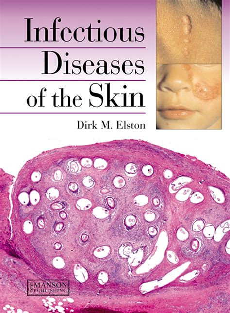 Manual of Diseases of the Skin Epub