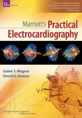 Marriott's Practical Electrocardiography 12th Edition Doc