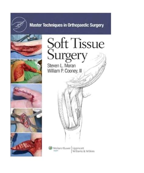 Master Techniques in Orthopaedic Surgery Soft Tissue Surgery 1st Edition Reader