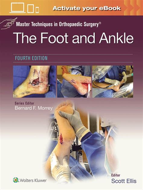 Master Techniques in Orthopaedic Surgery The Foot and Ankle Epub