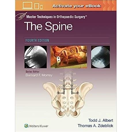 Master Techniques in Orthopaedic Surgery The Spine 2nd Edition Reader