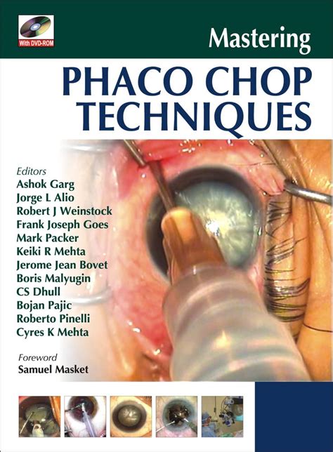 Mastering Phaco Chop Techniques Epub