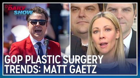 Matt Gaetz Plastic Surgery Tweets: A Comprehensive Analysis