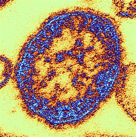Measles Virus Reader
