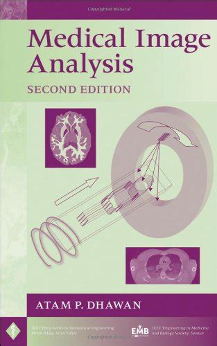 Medical Image Analysis (IEEE Biomedical Engineering) [PDF] Doc