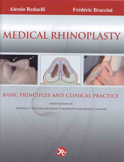 Medical Rhinoplasty Basic Principles and Clinical Practice Epub