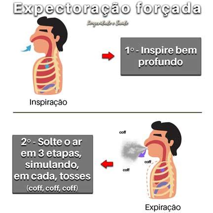 Melhora da expectoração: