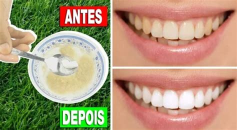 Melhore Seu Sorriso: Um Guia Completo para Produtos para Clarear os Dentes