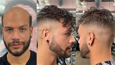 Men's Hair System