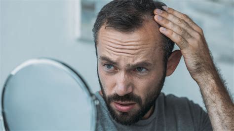 Men's Hair System: The Ultimate Solution for Hair Loss